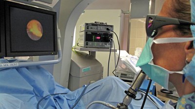 Лазерная уретеролитотрипсия